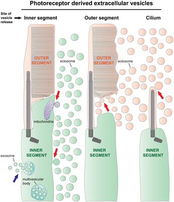 Extracellular vesicles highlight many cases of photoreceptor degeneration